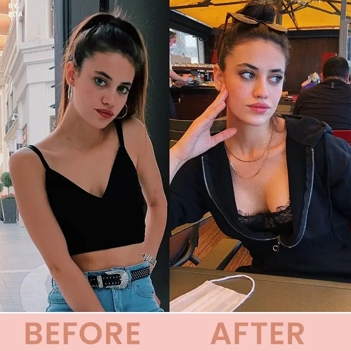 LIMETOW® Bust Lift Oil