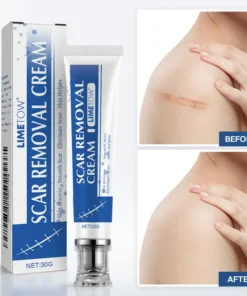 LIMETOW® Scar Removal Cream