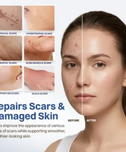 LIMETOW® Scar Removal Cream