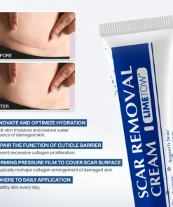 LIMETOW® Scar Removal Cream
