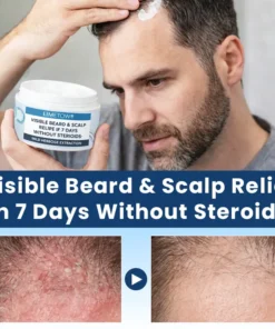 LIMETOW® Visible Beard & Scalp Relief in 7 Days Without Steroids