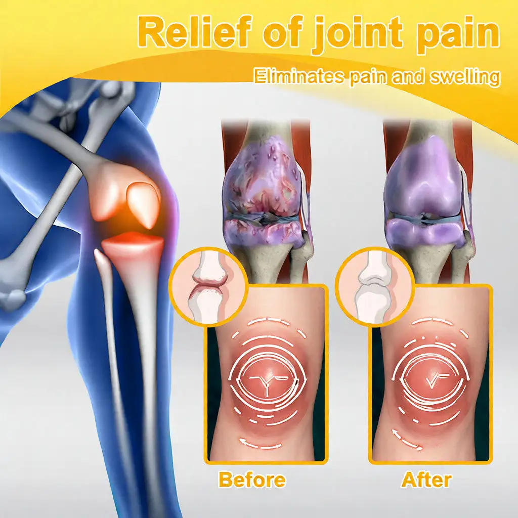 Bee Poison Pain-Relief Bone Healing Cream (Specially for older adults) - Image 12