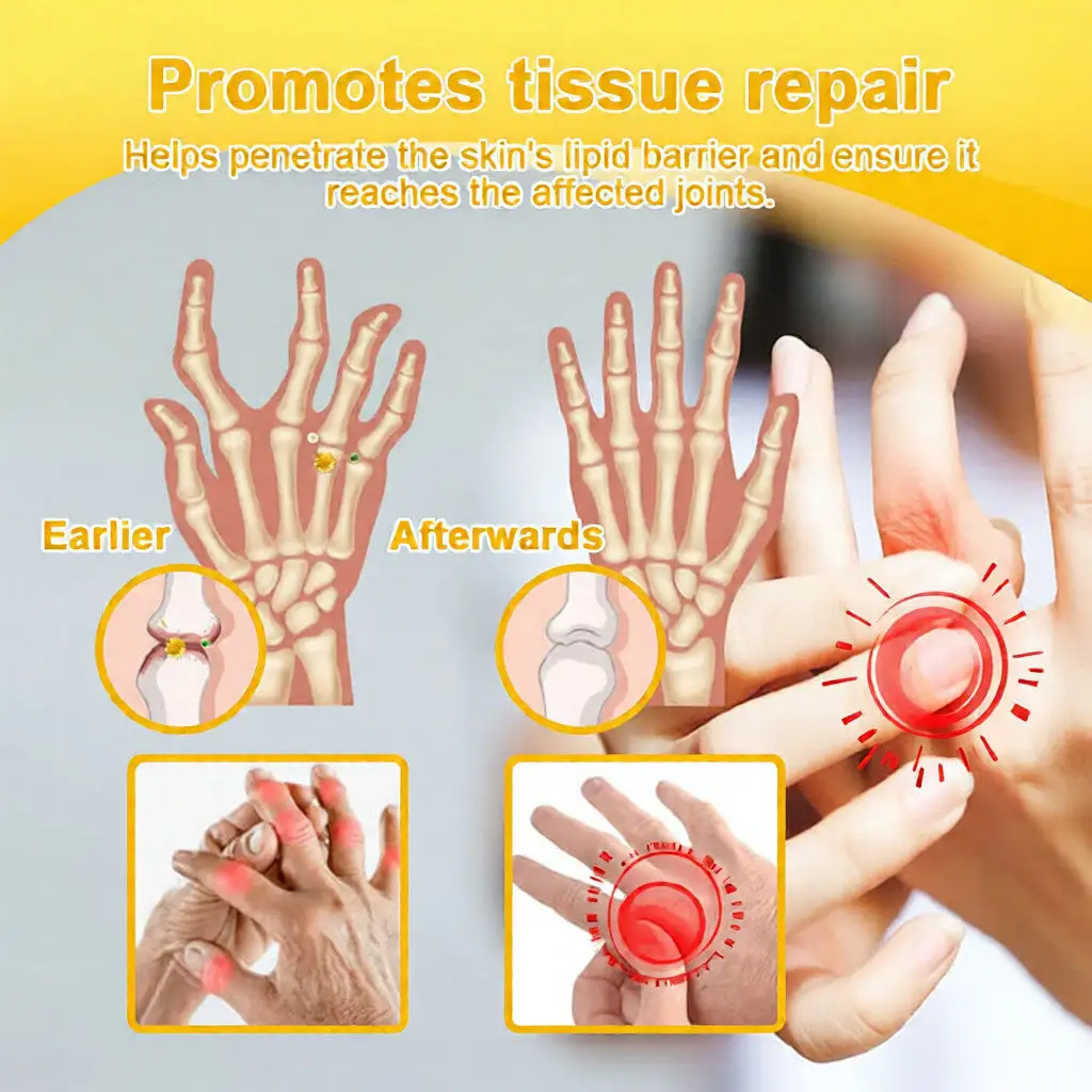 Bee Poison Pain-Relief Bone Healing Cream (Specially for older adults) - Image 13