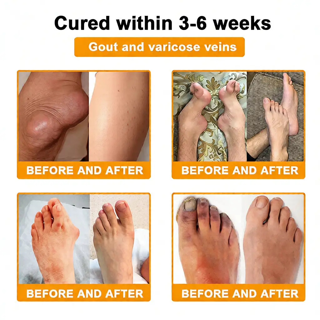 Bee Poison Pain-Relief Bone Healing Cream (Specially for older adults) - Image 3