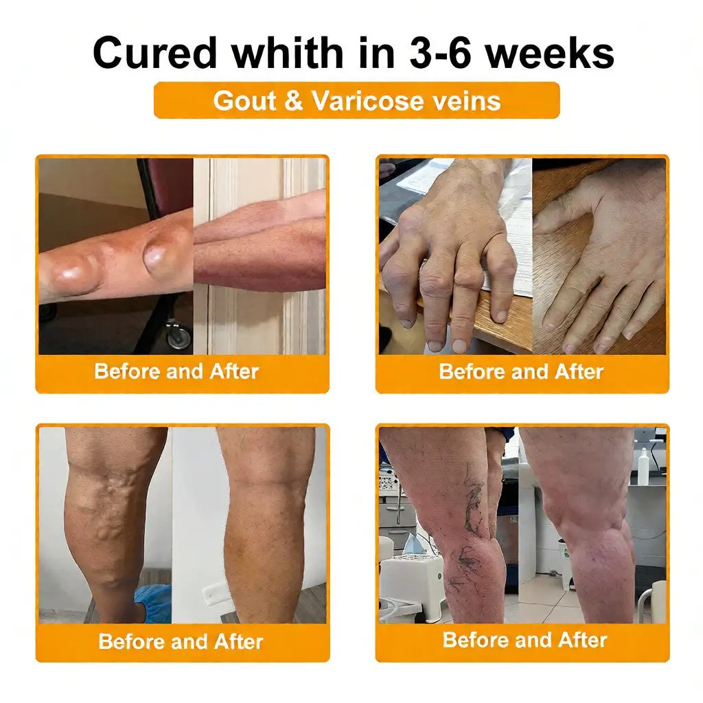 Bee Poison Pain-Relief Bone Healing Cream (Specially for older adults) - Image 5