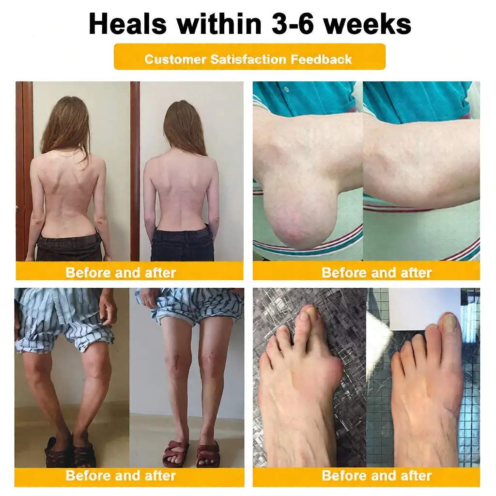 Bee Poison Pain-Relief Bone Healing Cream (Specially for older adults) - Image 6