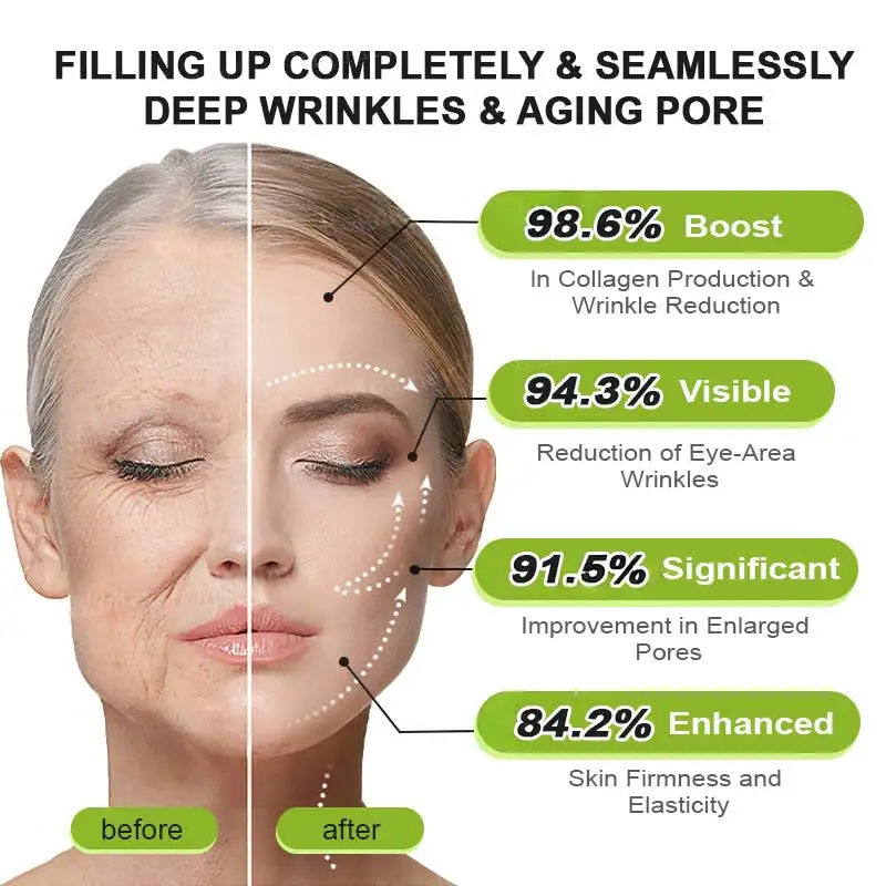 moringa Vita-A Retinol Shot Wrinkle-Lift Tightening cream - Last Day Promotion 50 OFF - Image 15