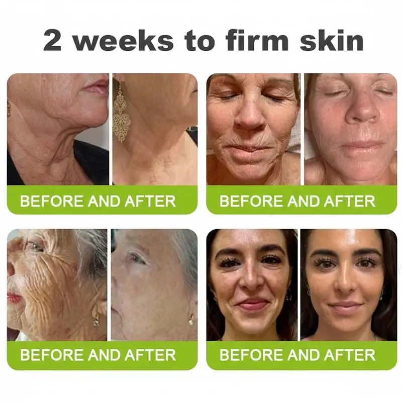 moringa Vita-A Retinol Shot Wrinkle-Lift Tightening cream - Last Day Promotion 50 OFF - Image 7