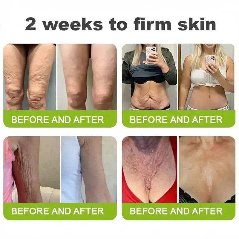 moringa Vita-A Retinol Shot Wrinkle-Lift Tightening cream - Last Day Promotion 50 OFF - Image 8