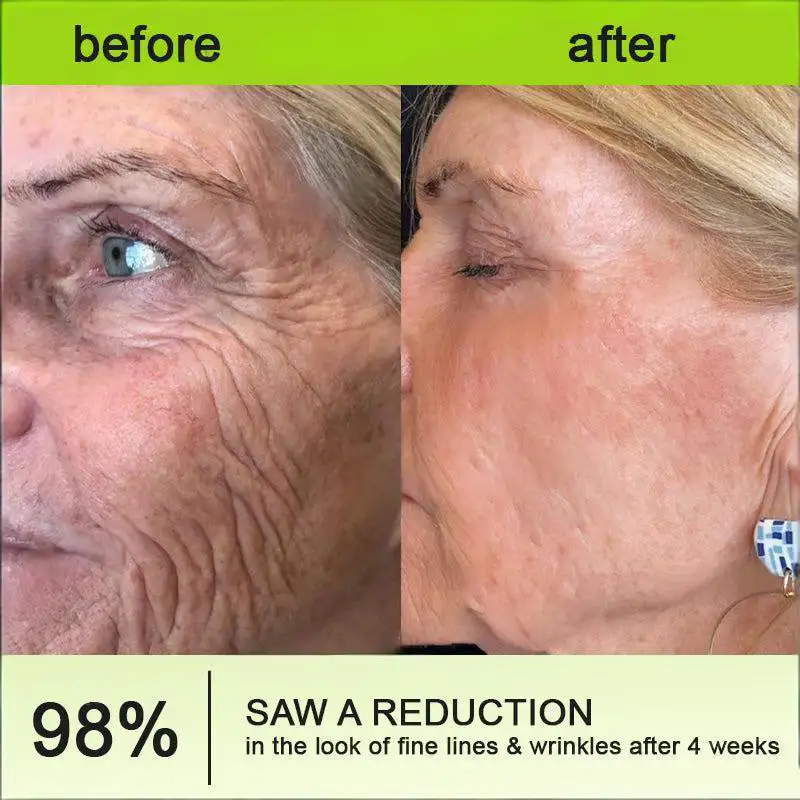 Botin Vita-A Retinol Shot Wrinkle-Lift Tightening cream - Last Day Promotion 70 OFF - Image 10