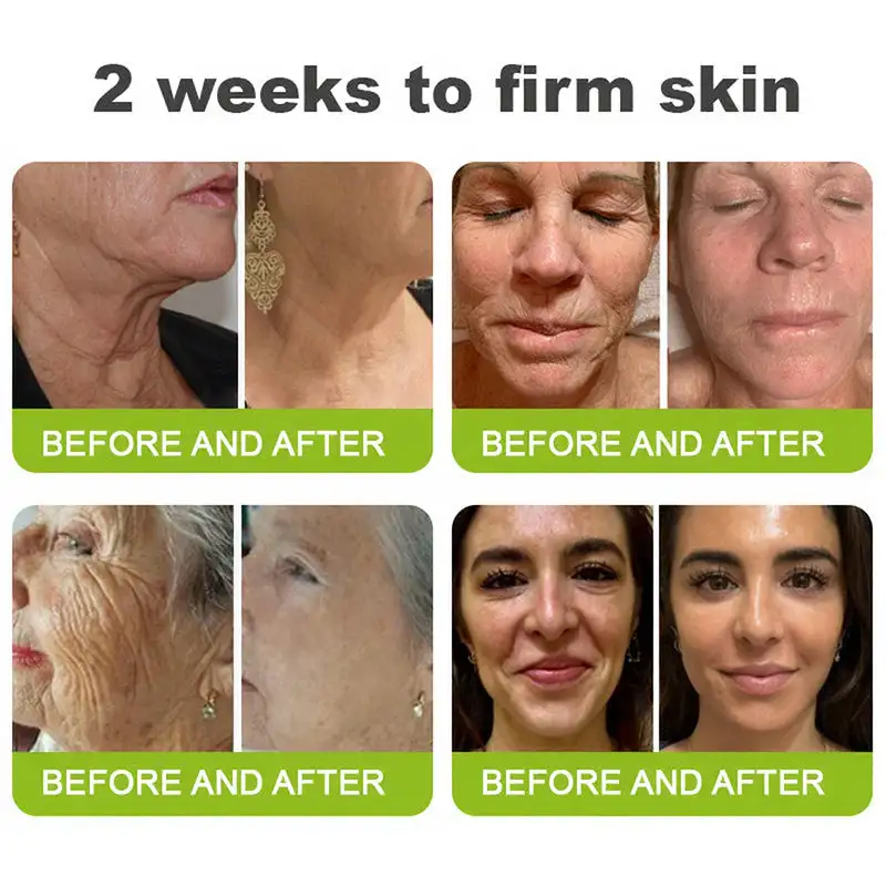 Botin Vita-A Retinol Shot Wrinkle-Lift Tightening cream - Last Day Promotion 70 OFF - Image 2