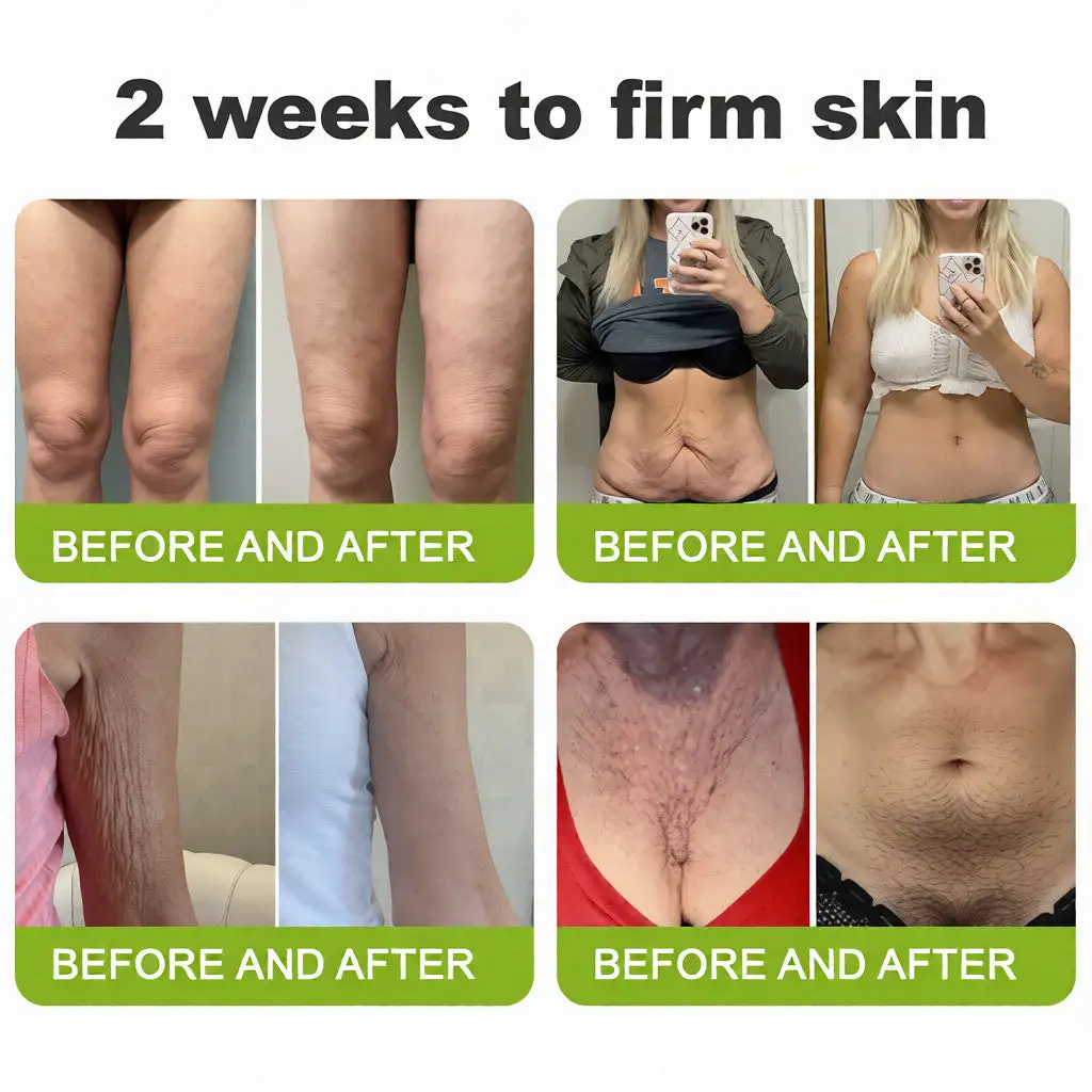 Botin Vita-A Retinol Shot Wrinkle-Lift Tightening cream - Last Day Promotion 70 OFF - Image 8