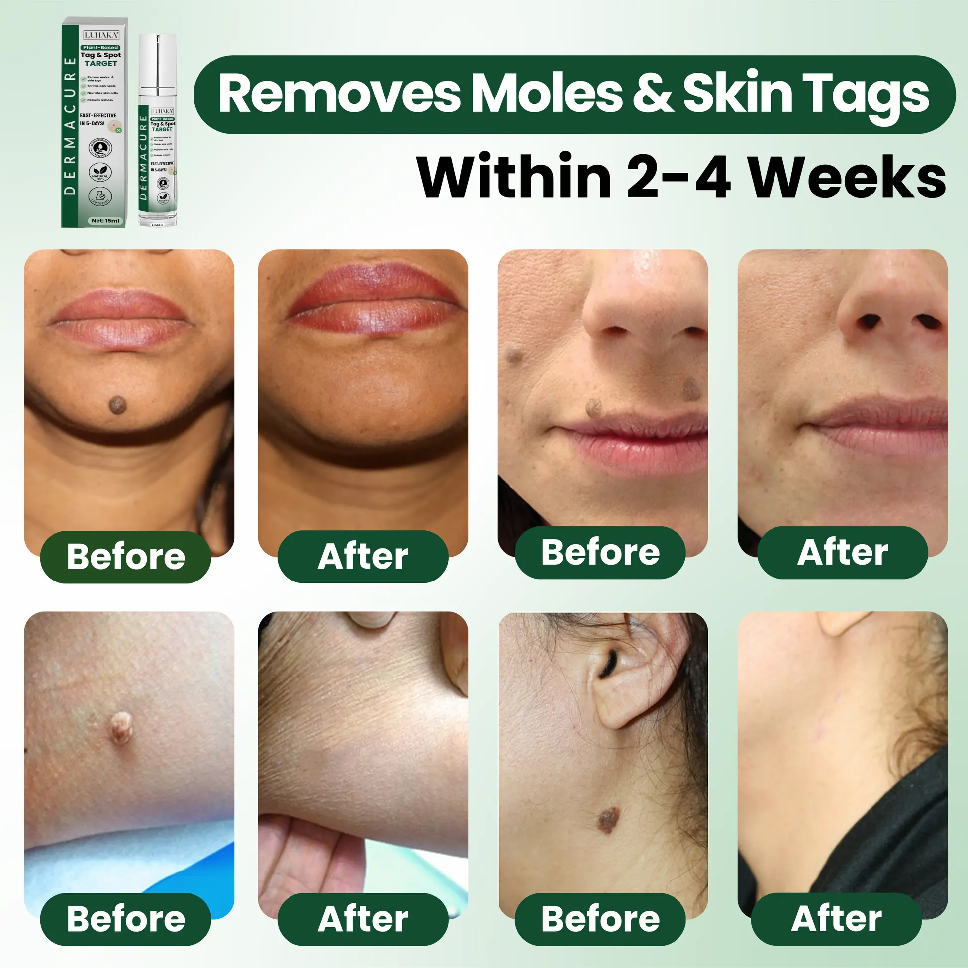 Reedle Shot 100 Tag Spot Target Advanced Serum ACE - Image 9