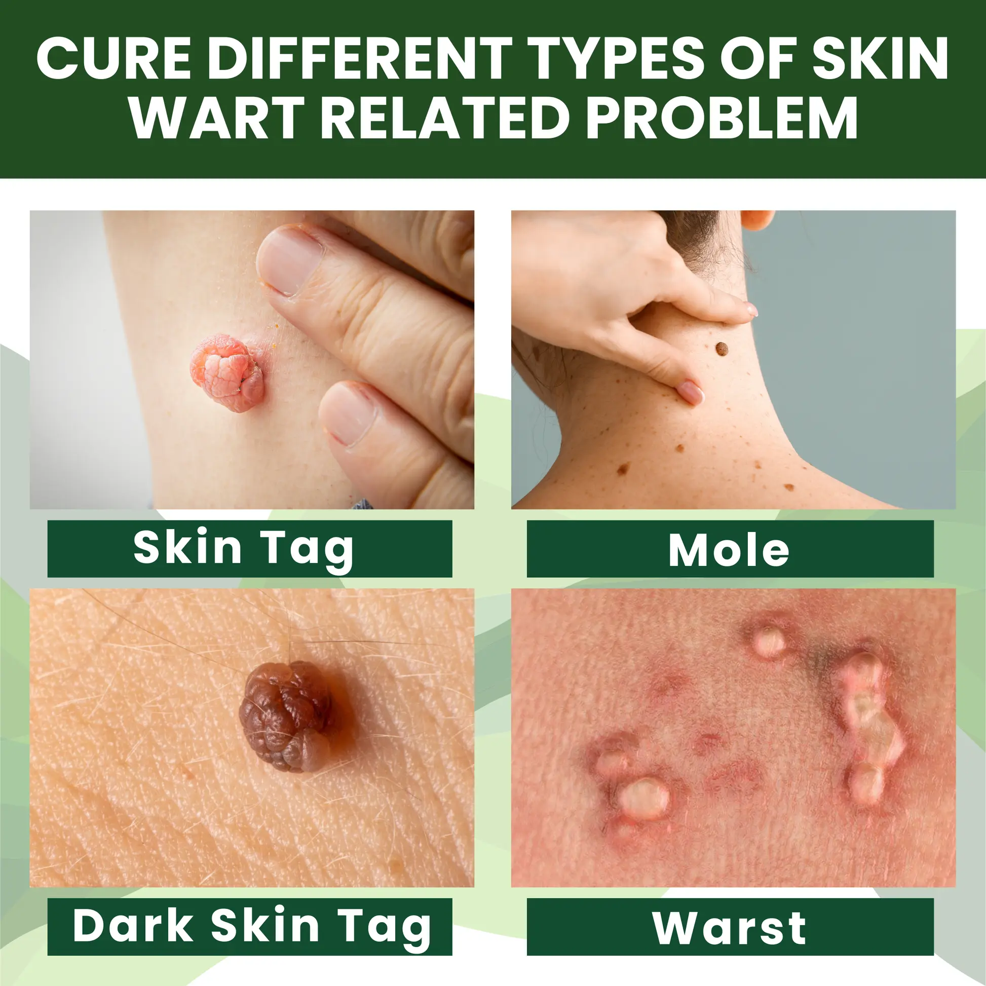 Reedle Shot 100 Tag Spot Target Advanced Serum ACE - Image 10