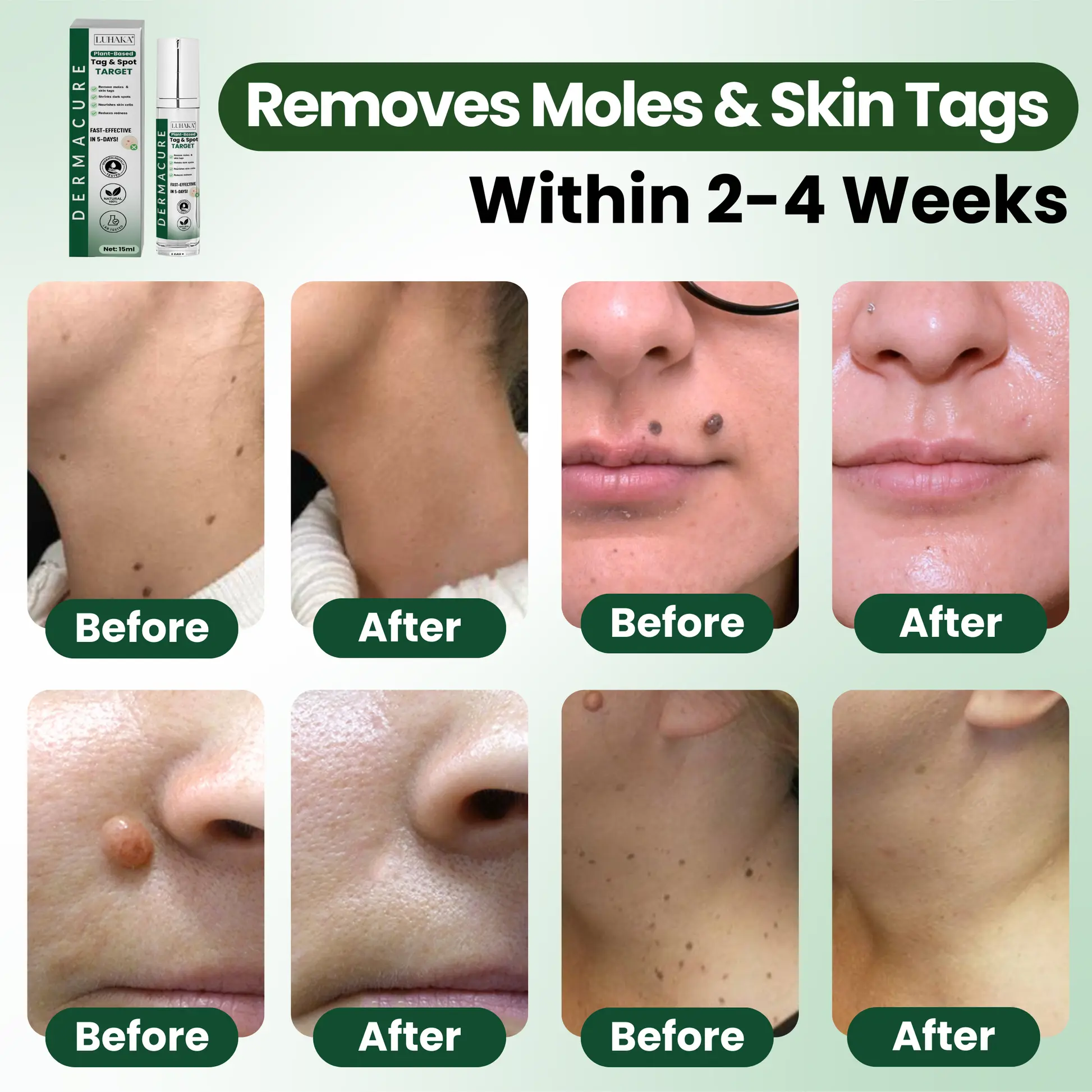 Reedle Shot 100 Tag Spot Target Advanced Serum ACE - Image 2