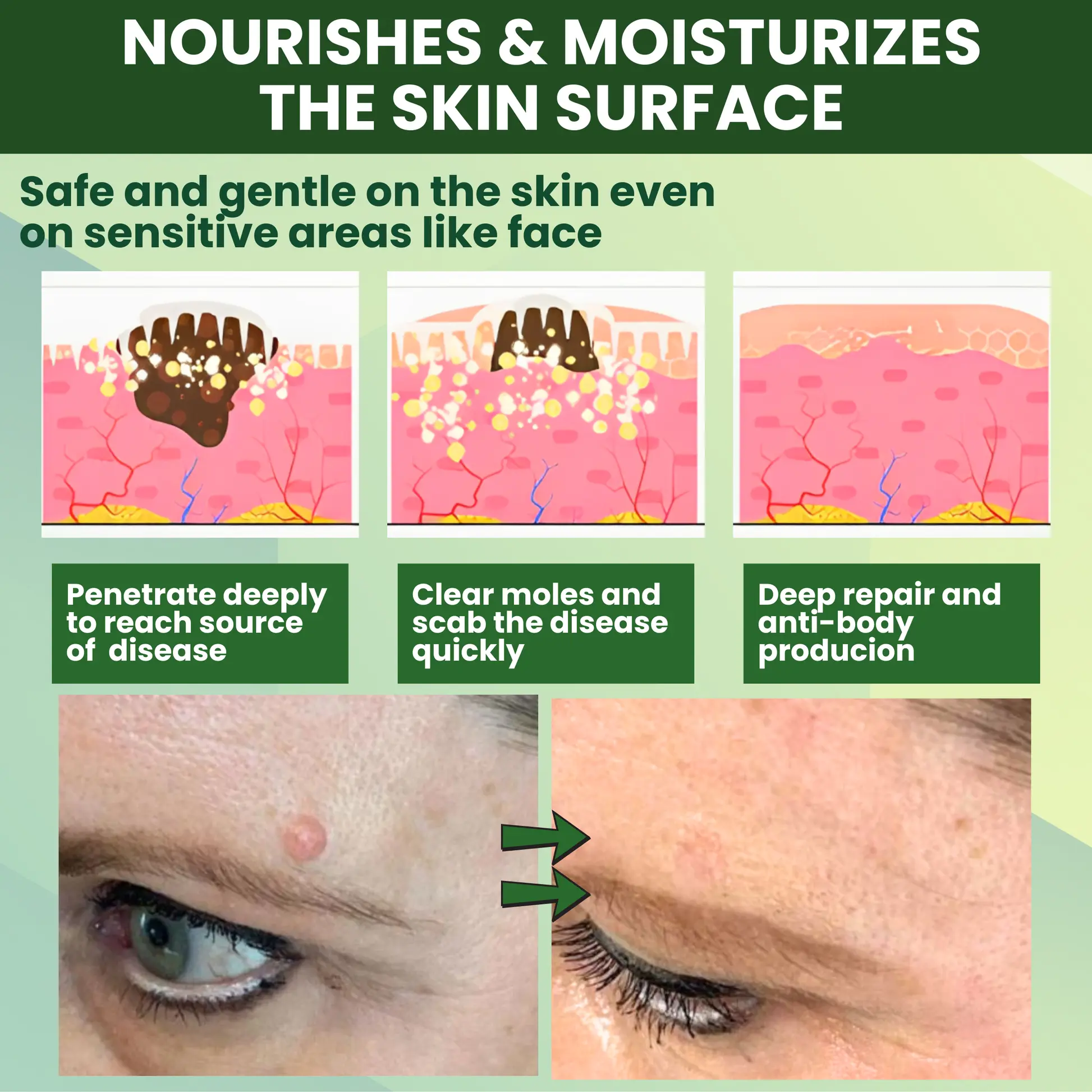 Reedle Shot 100 Tag Spot Target Advanced Serum ACE - Image 3