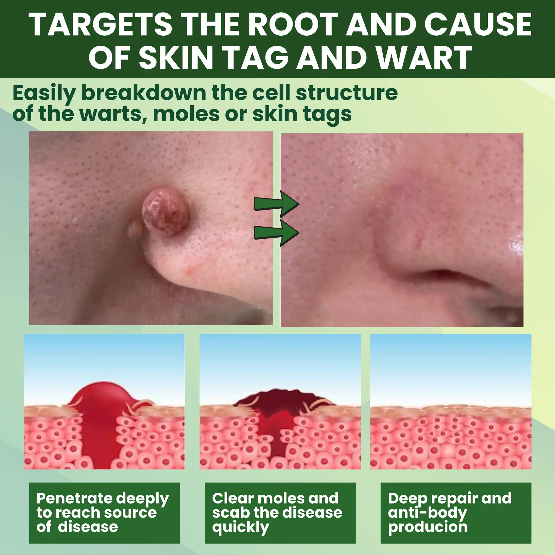 Reedle Shot 100 Tag Spot Target Advanced Serum ACE - Image 6