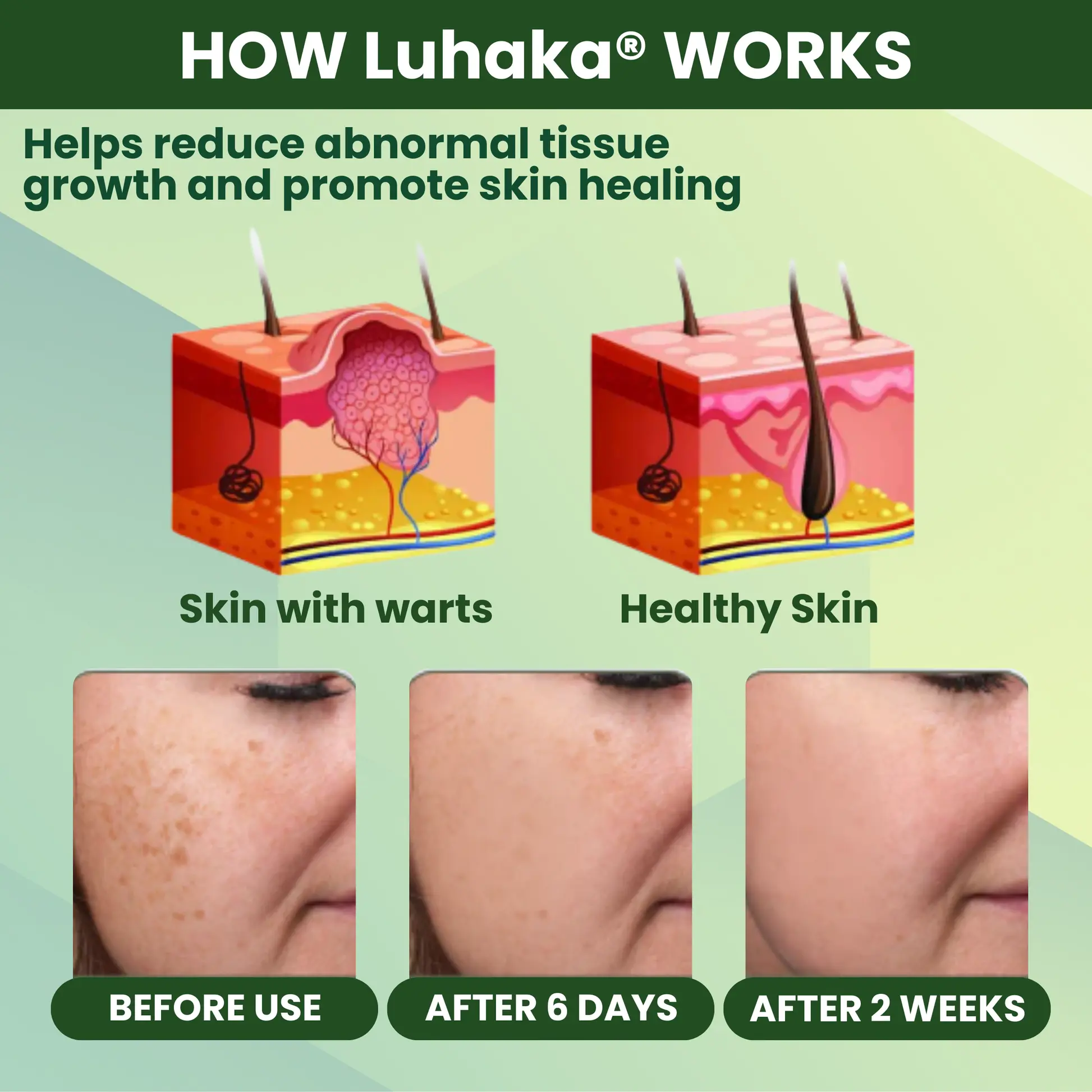 Reedle Shot 100 Tag Spot Target Advanced Serum ACE - Image 7