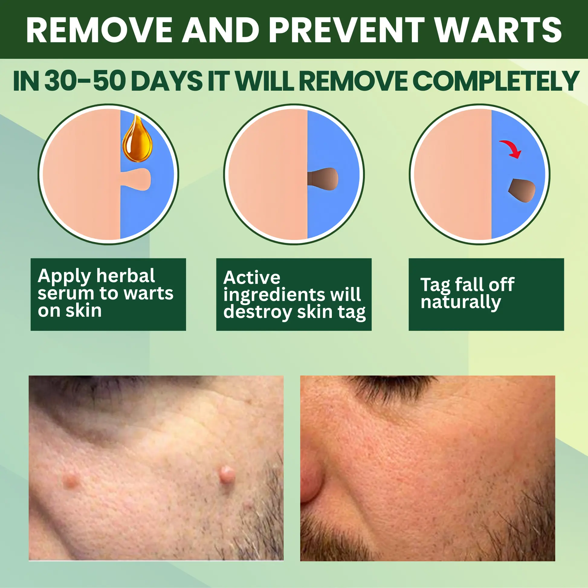 Reedle Shot 100 Tag Spot Target Advanced Serum ACE - Image 8