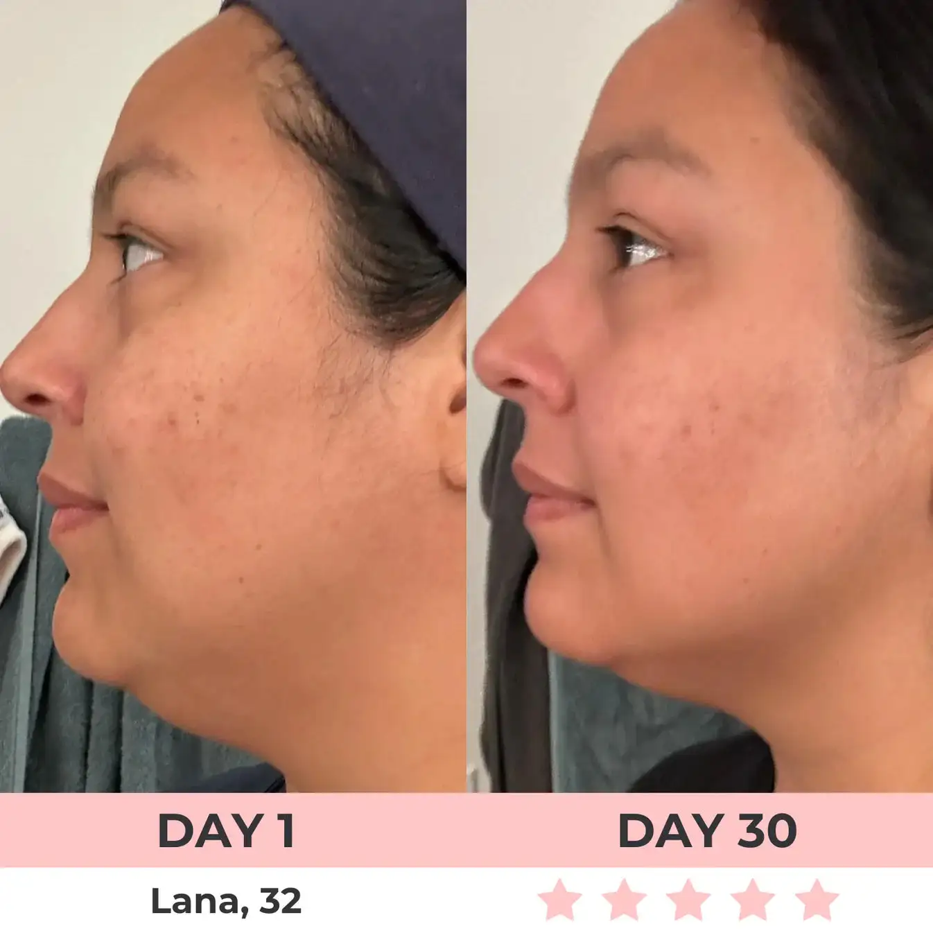 QIAWI 7-in-1 LED Facial Sculptor - Image 10