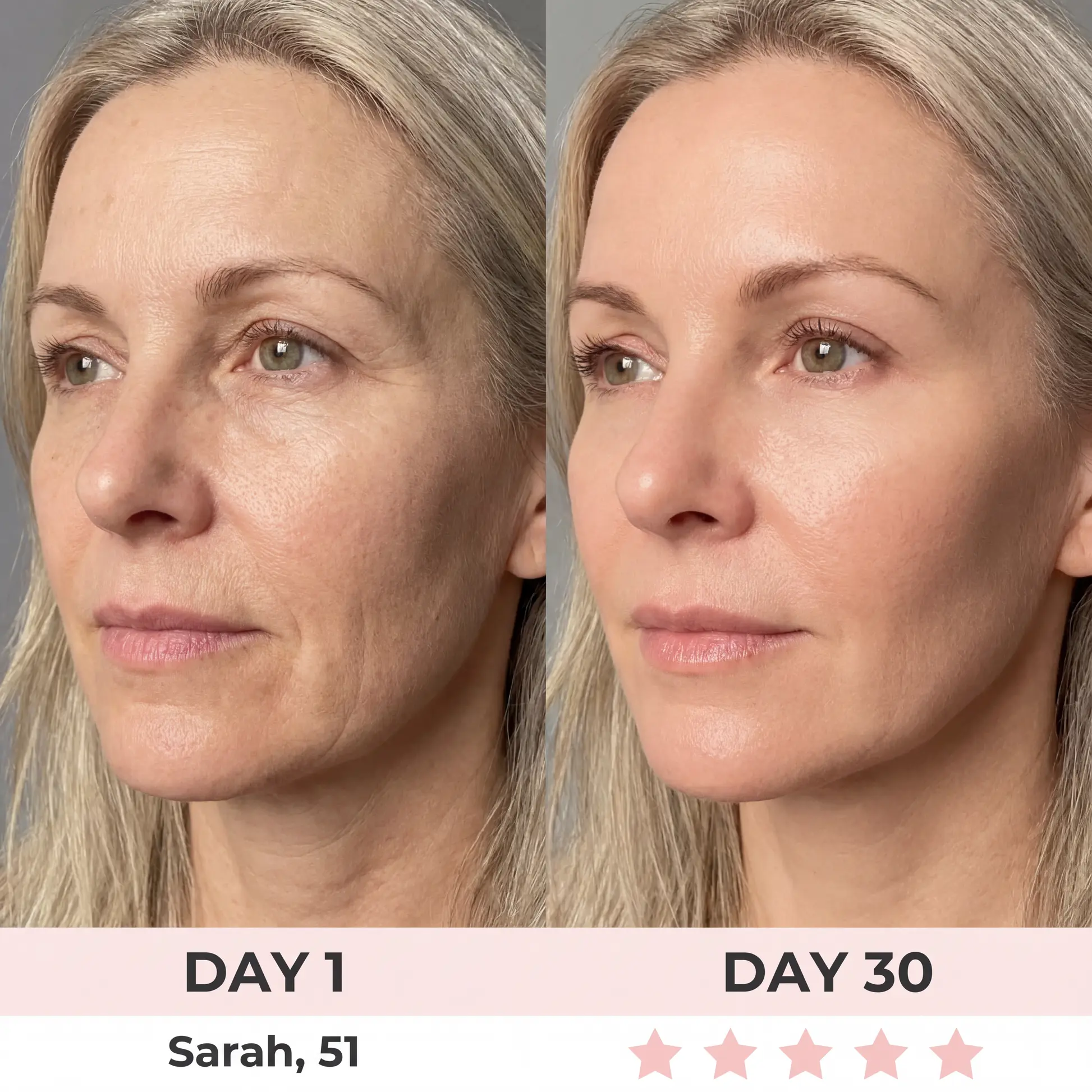 QIAWI 7-in-1 LED Facial Sculptor - Image 5