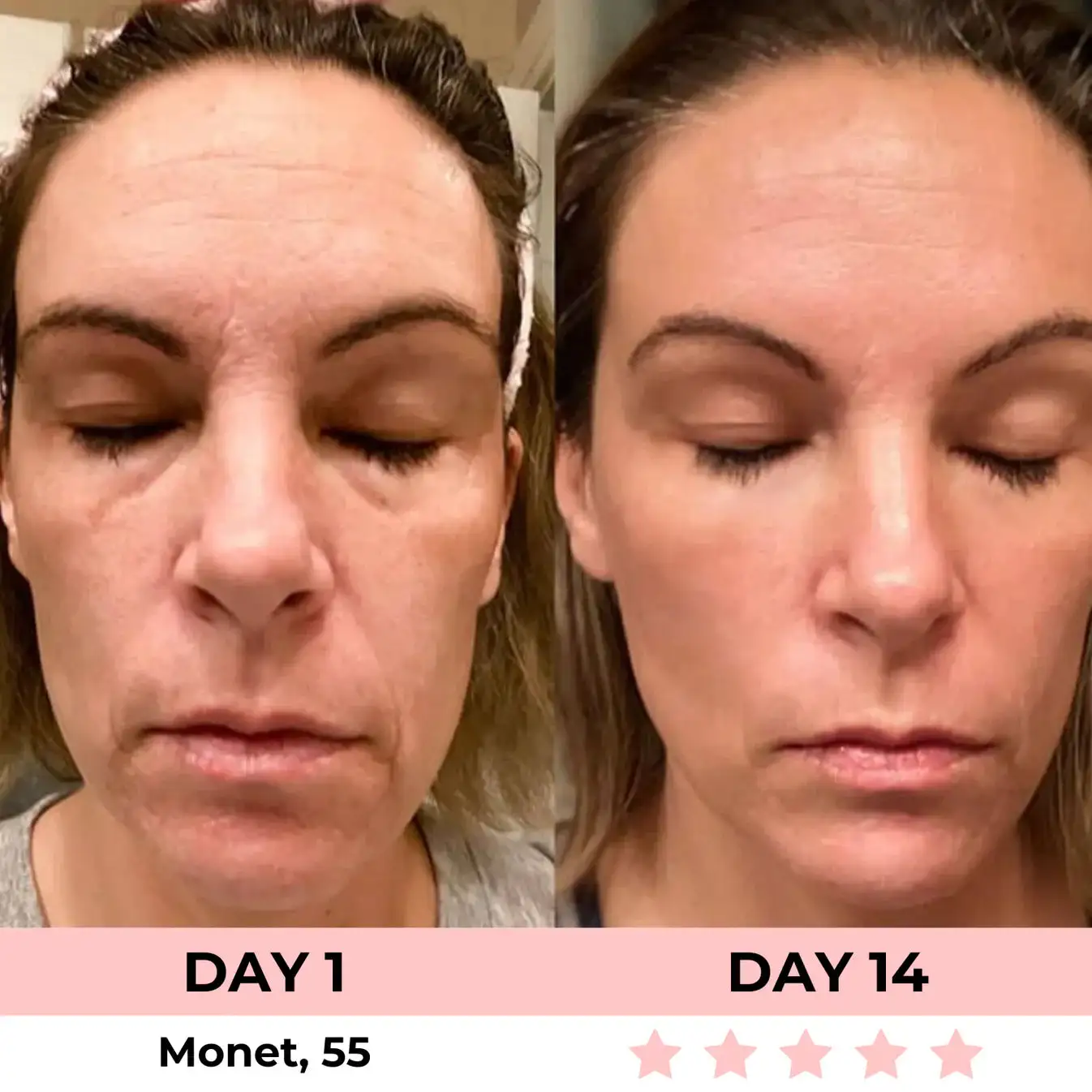 QIAWI 7-in-1 LED Facial Sculptor - Image 8