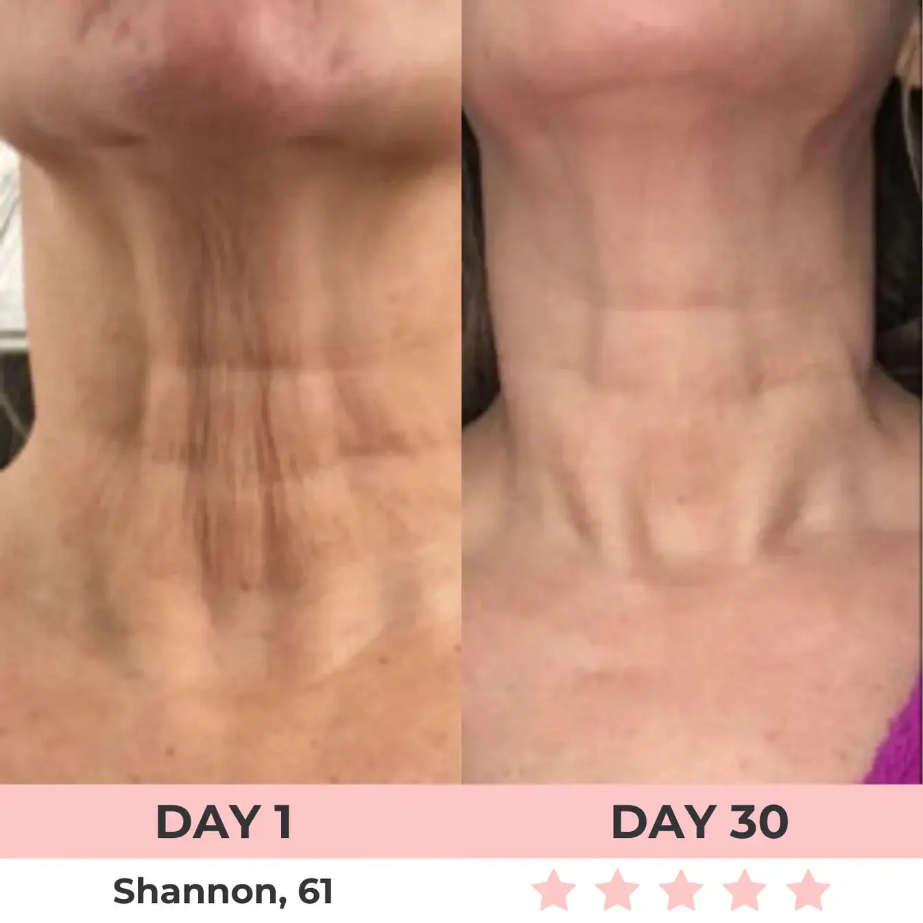 QIAWI 7-in-1 LED Facial Sculptor - Image 9