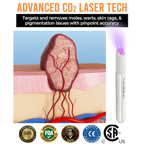 All-in-One CO₂ Laser Eraser Pen Removes Moles, Warts, Skin Flaws Pigmentation - Image 15
