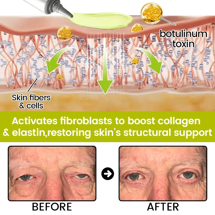 Botox Retinol Shot Smoother-Looking Skin for Deep Lines, Sagging Jowls Puffy Eyes - Image 11