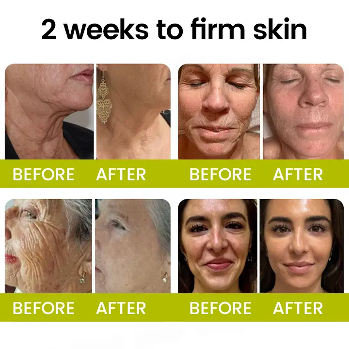 Botox Retinol Shot Smoother-Looking Skin for Deep Lines, Sagging Jowls Puffy Eyes - Image 2