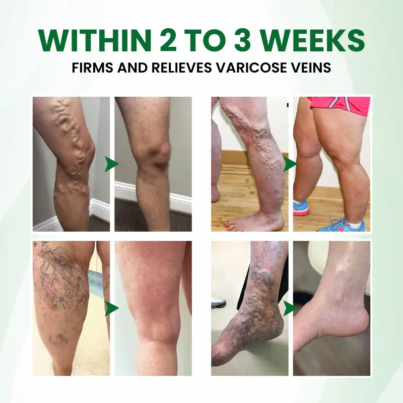 Phyto-Vascular Microneedle Patch - Image 2