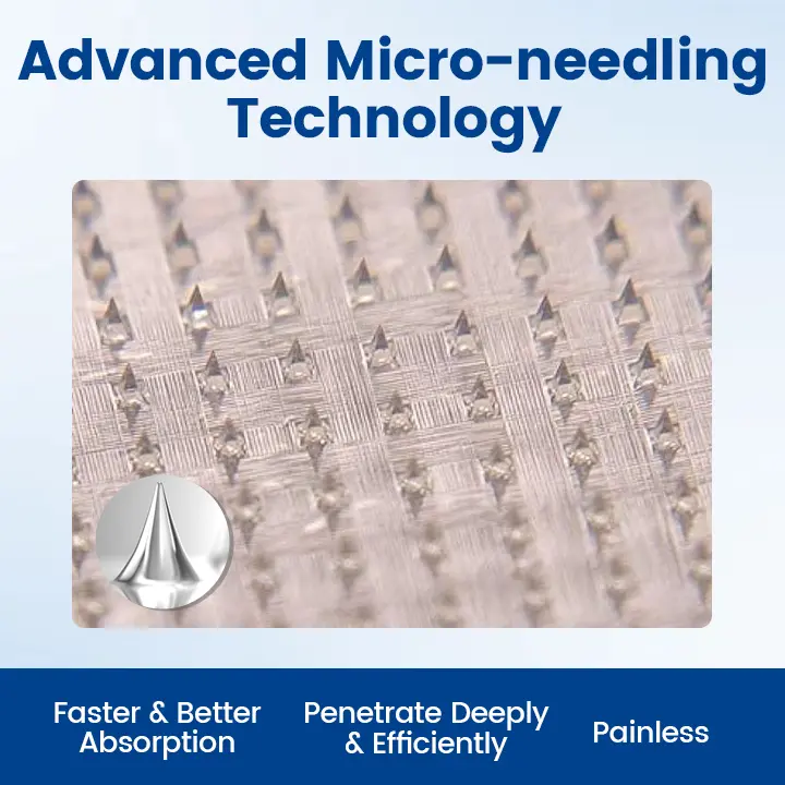 Vein Ease Microneedle Therapy Patch – Fast Effective and Non-Invasive Treatment for Varicose Veins Leg Swelling - Image 2