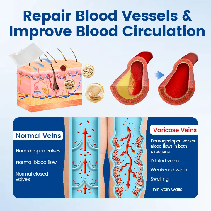 Vein Ease Microneedle Therapy Patch - Fast ⚡Effective 💪 and Non-Invasive 🚫 Treatment for Varicose Veins & Leg Swelling 👣 - Image 6