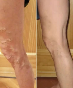 LIMETOW® Leg Relief Cream