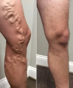 LIMETOW® Leg Relief Cream