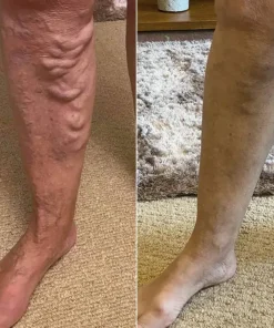 LIMETOW® Leg Relief Cream
