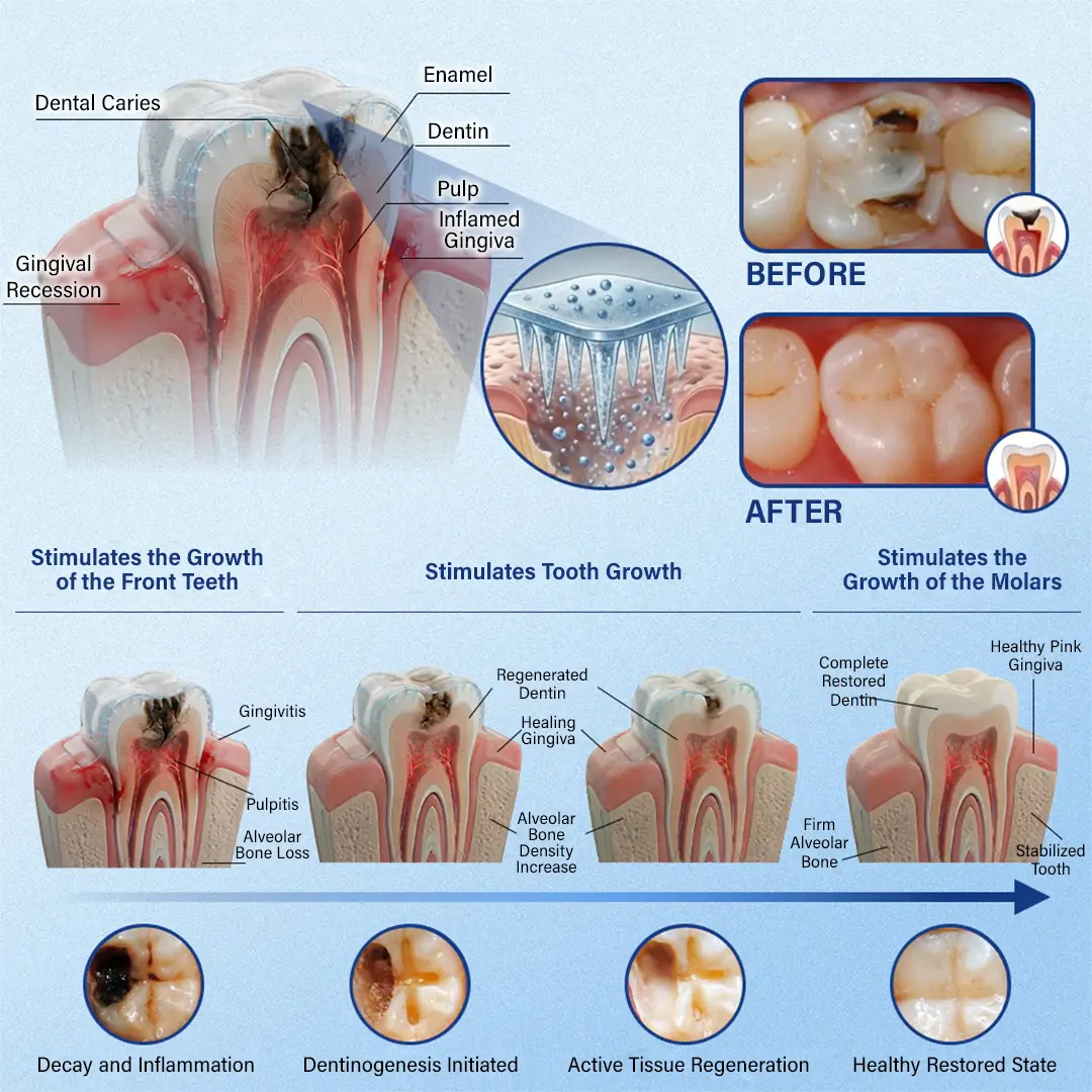 Tooth & Gum Repair Fast-Dissolving Microneedle Patch - Image 6