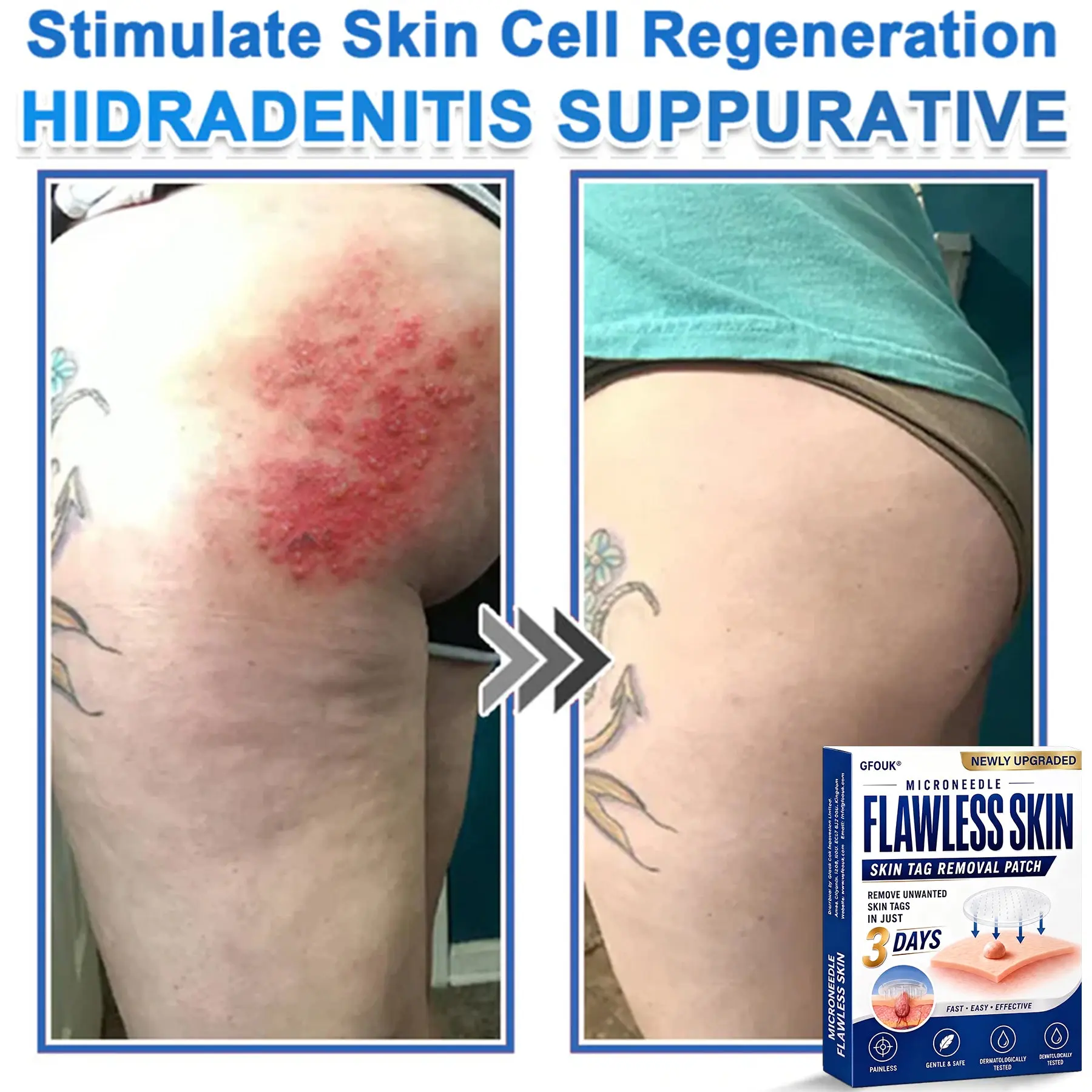 2026 Newly Upgraded 2-in-1 Microneedle Hydrocolloid Patches - Image 10