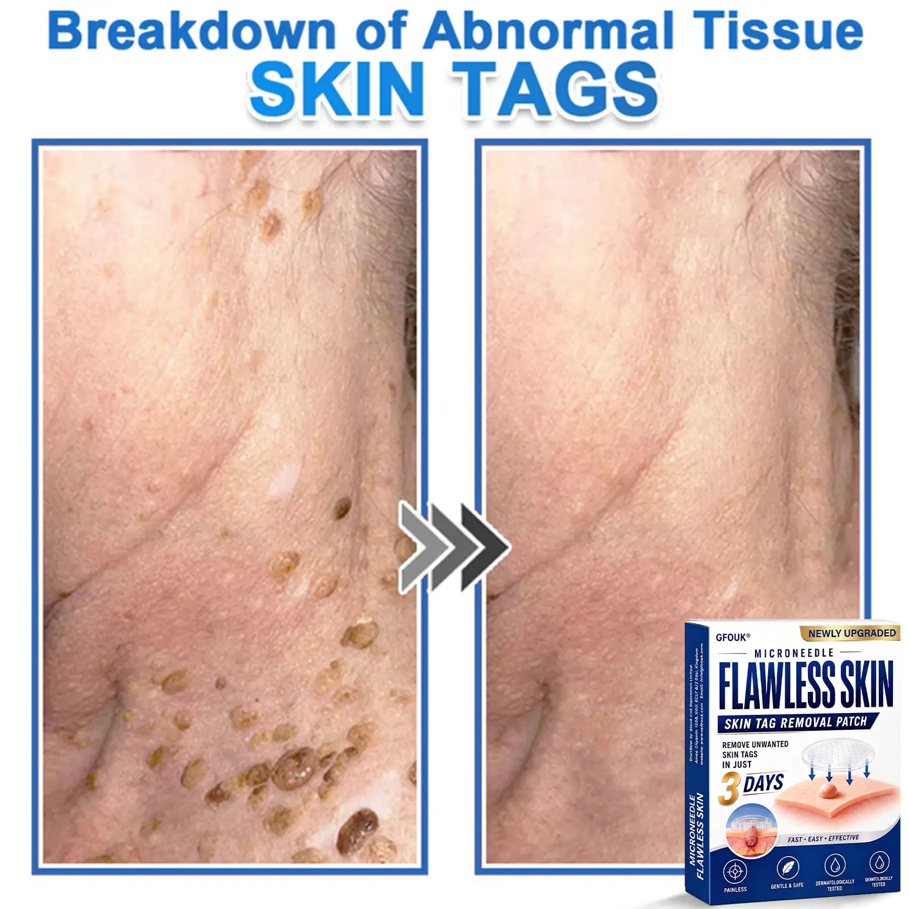 2026 Newly Upgraded 2-in-1 Microneedle Hydrocolloid Patches - Image 11