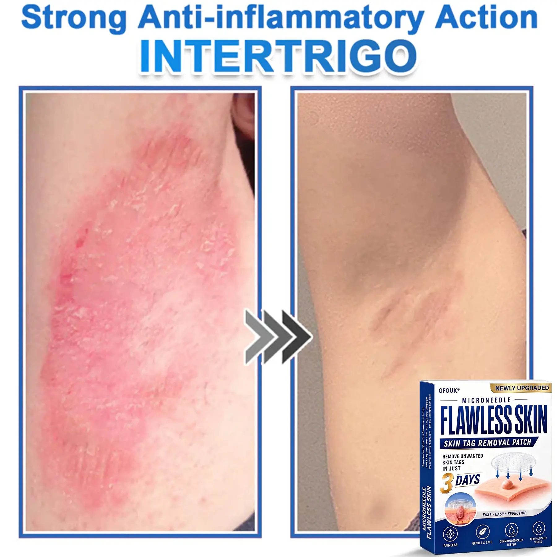 2026 Newly Upgraded 2-in-1 Microneedle Hydrocolloid Patches - Image 12