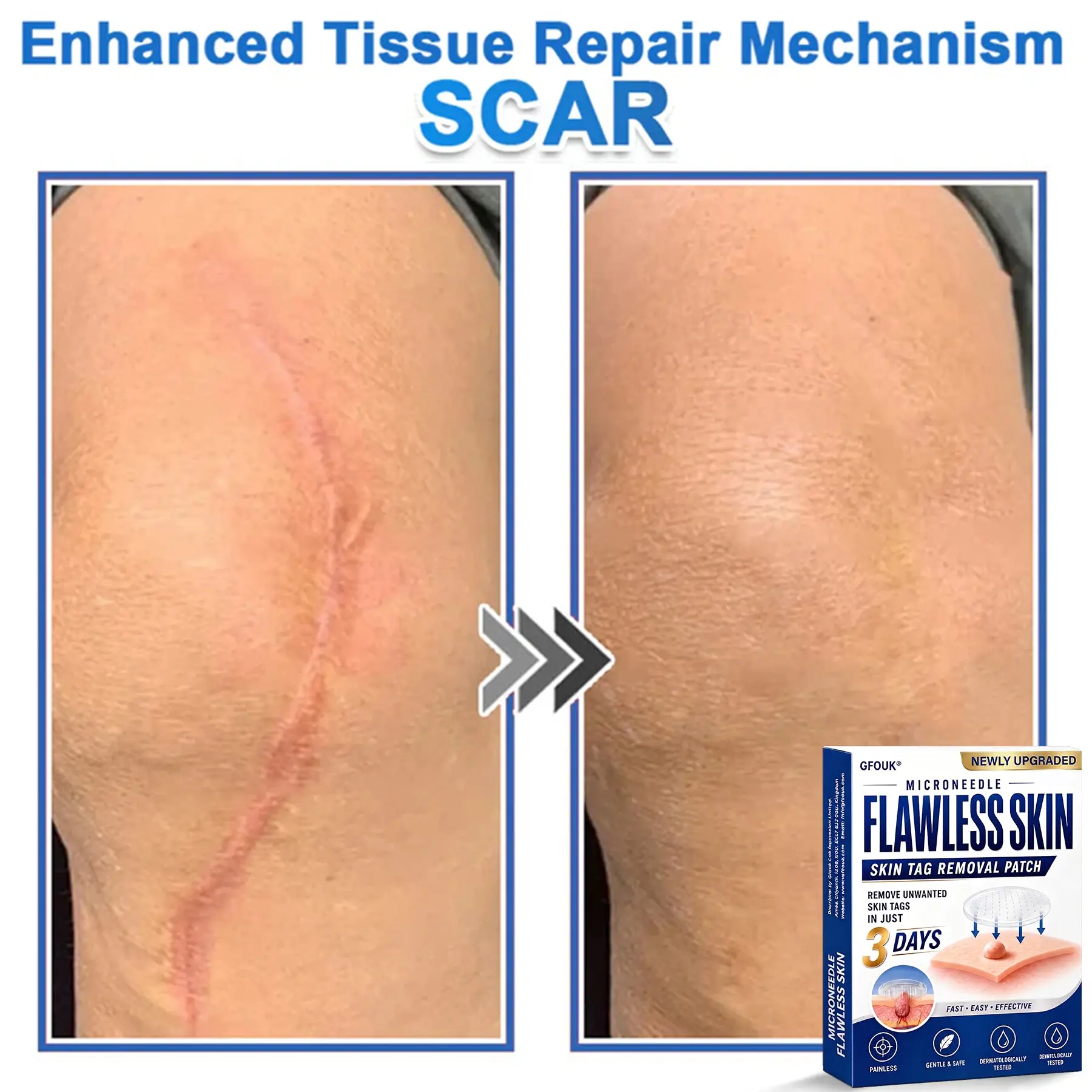 2026 Newly Upgraded 2-in-1 Microneedle Hydrocolloid Patches - Image 13