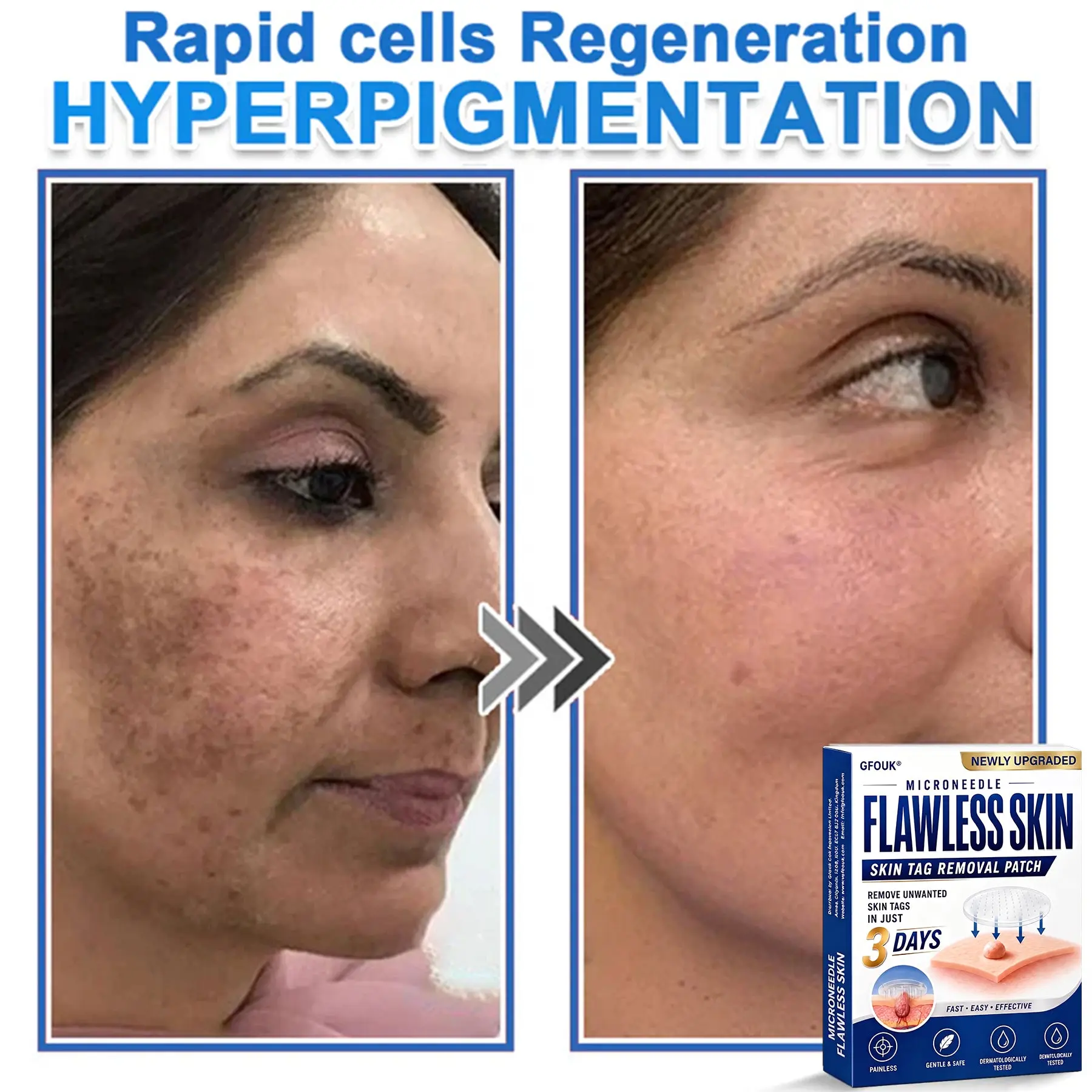 2026 Newly Upgraded 2-in-1 Microneedle Hydrocolloid Patches - Image 14