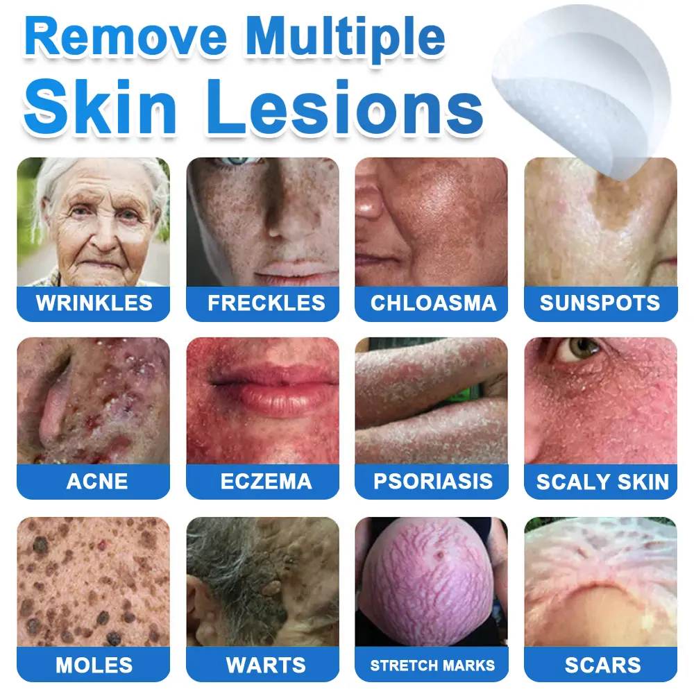2026 Newly Upgraded 2-in-1 Microneedle Hydrocolloid Patches - Image 2