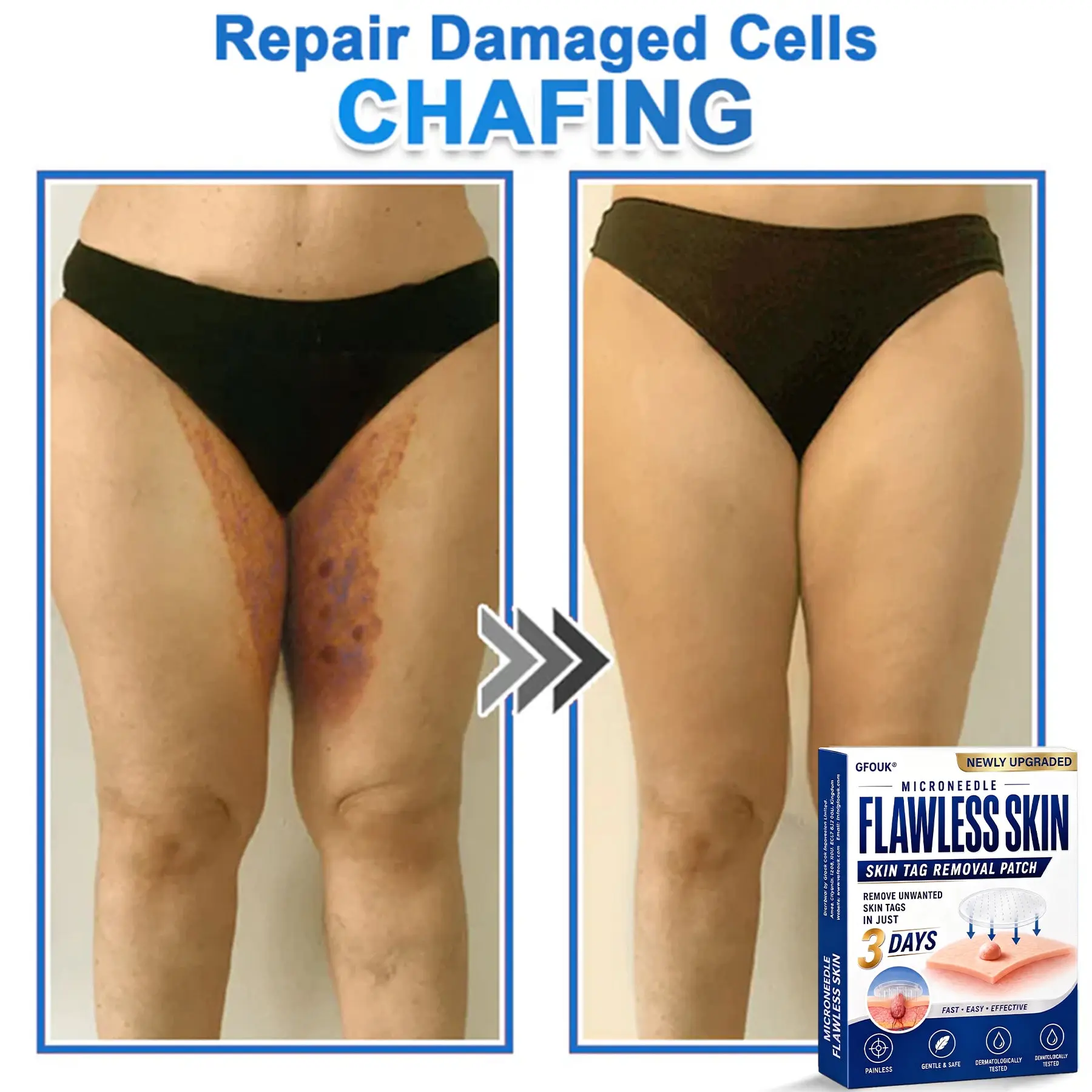 2026 Newly Upgraded 2-in-1 Microneedle Hydrocolloid Patches - Image 4