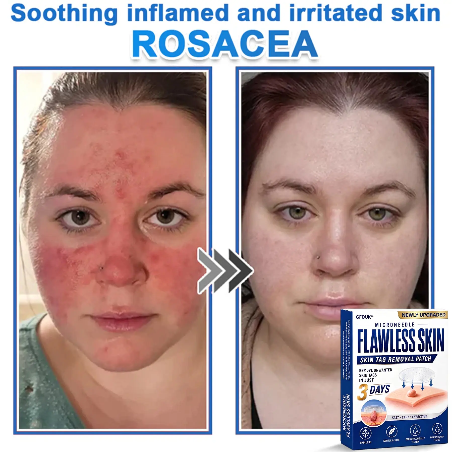2026 Newly Upgraded 2-in-1 Microneedle Hydrocolloid Patches - Image 7