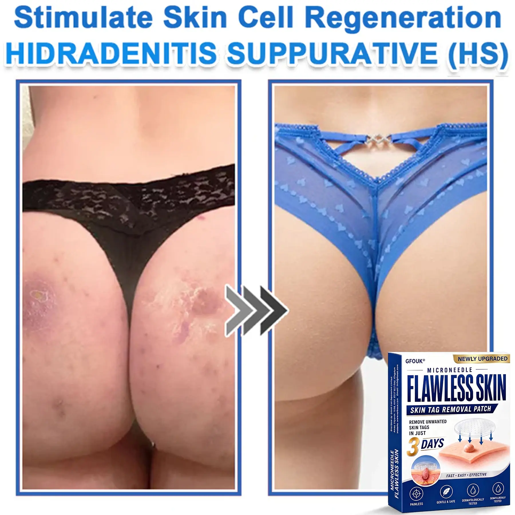 2026 Newly Upgraded 2-in-1 Microneedle Hydrocolloid Patches - Image 9