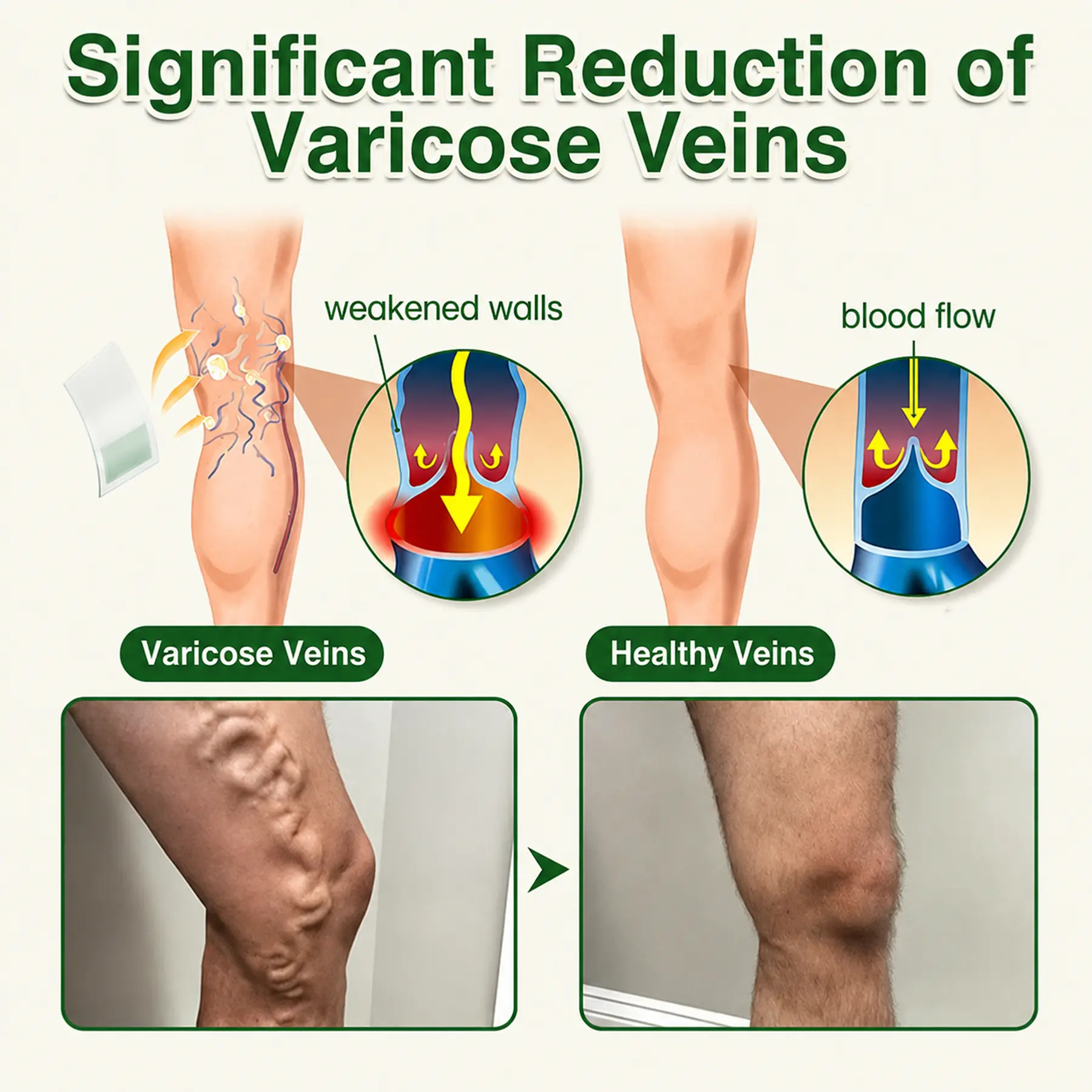 7-in-1 Microneedle Vein & Lipedema Treatment Patch - Image 10