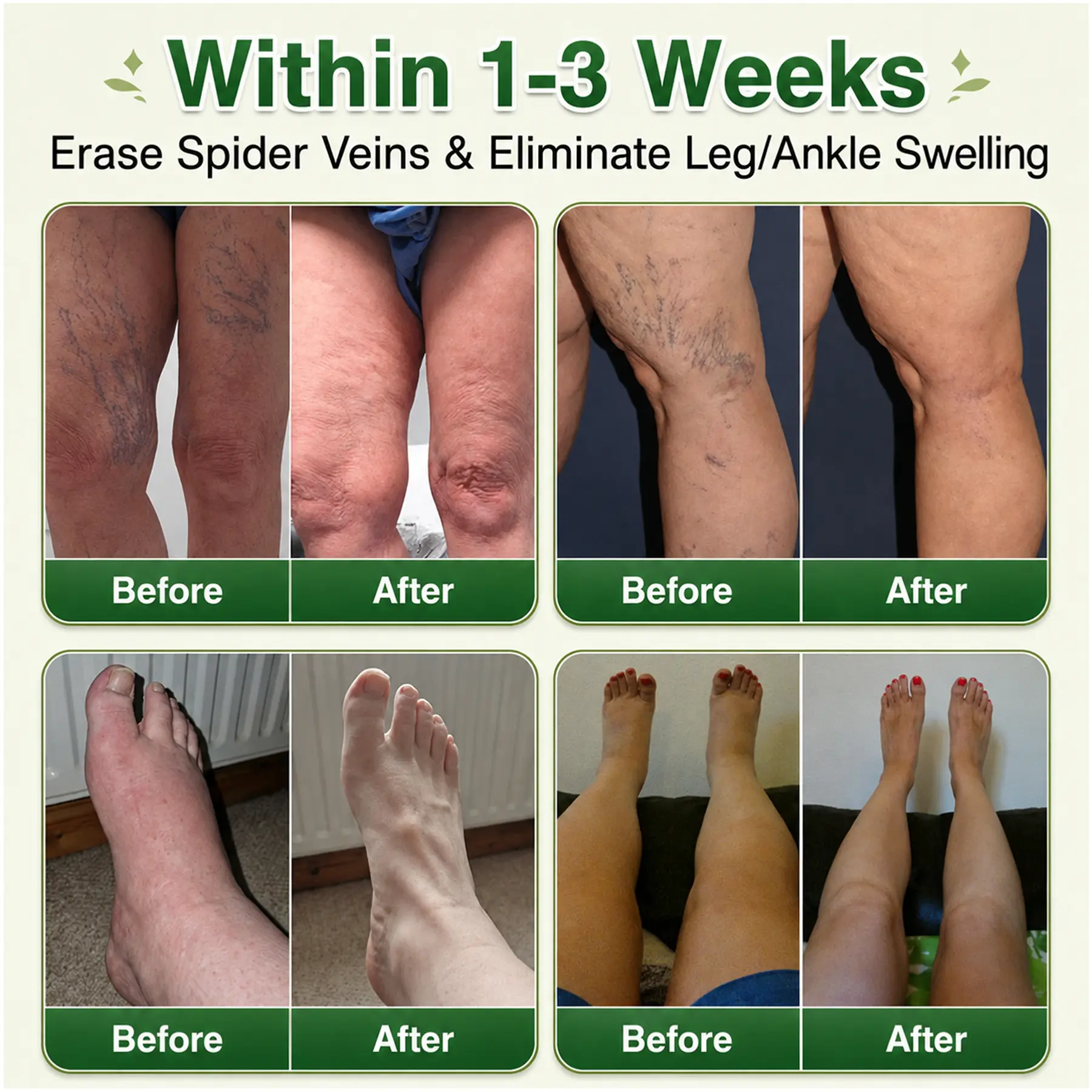 7-in-1 Microneedle Vein & Lipedema Treatment Patch - Image 3