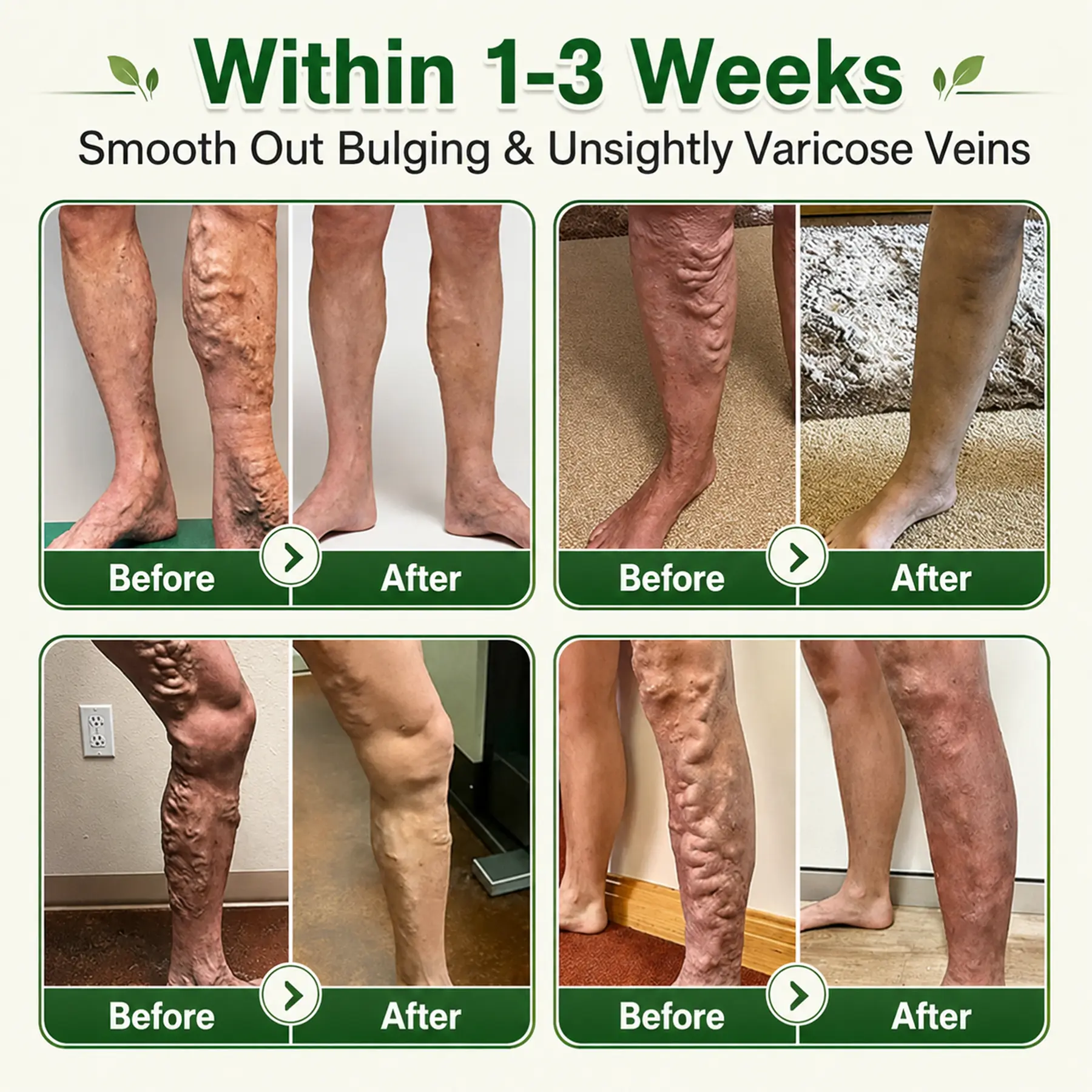 7-in-1 Microneedle Vein & Lipedema Treatment Patch - Image 4