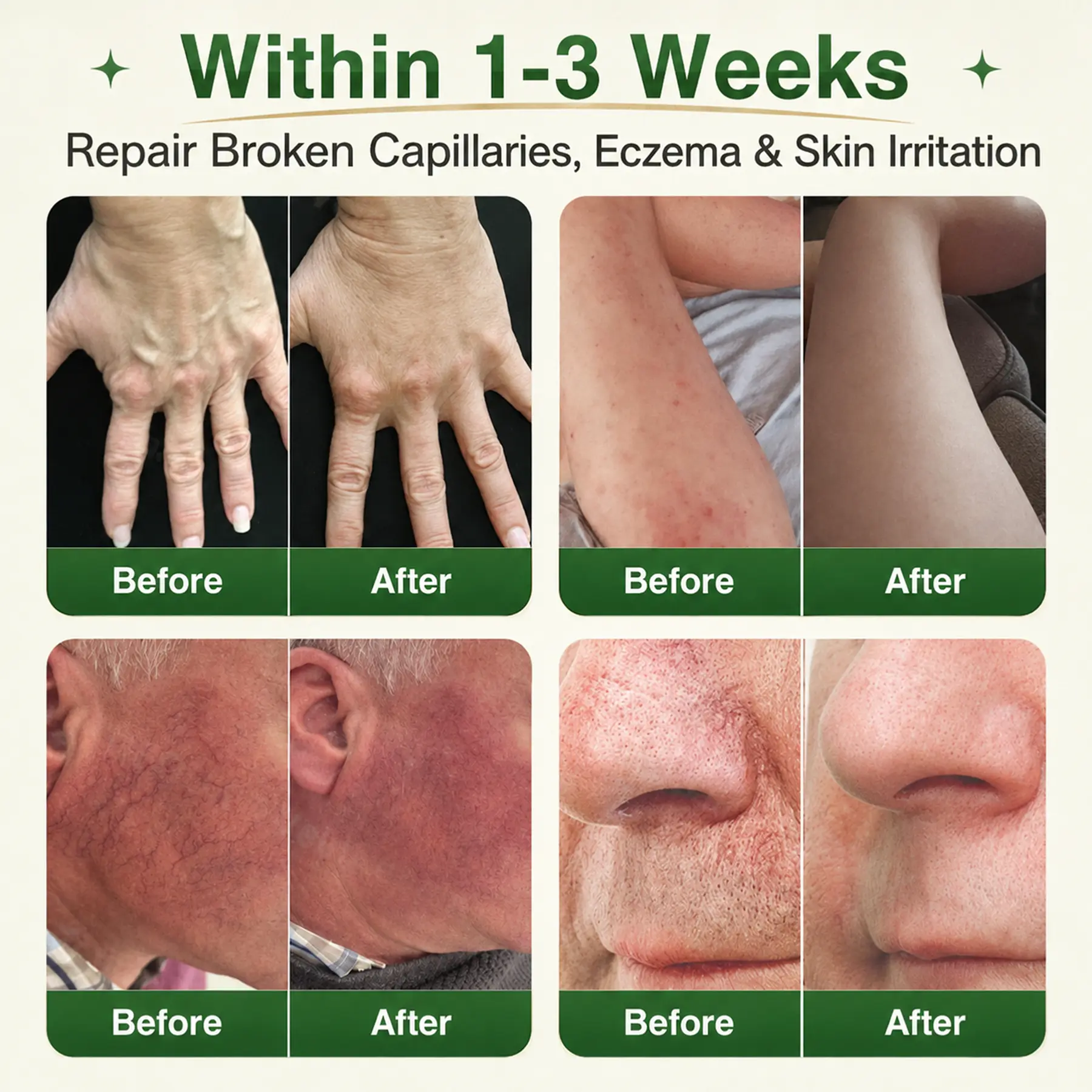 7-in-1 Microneedle Vein & Lipedema Treatment Patch - Image 5